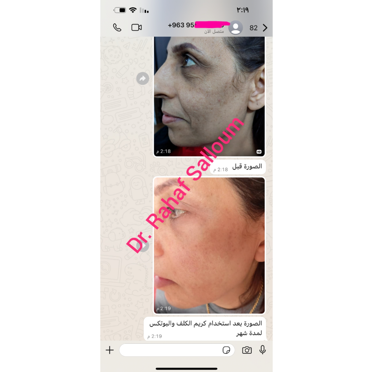 product img